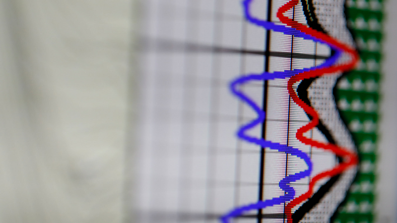 XMR™: best-in-class magnetic resonance logging